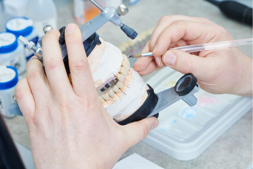 Prótesis dental sobre implantes
