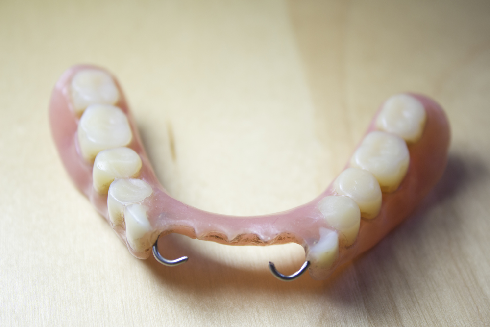 Prótesis dental removible